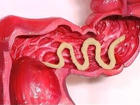 parasites dans le corps humain pourquoi ils apparaissent