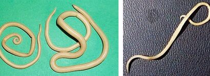 Quels parasites une personne peut-elle avoir 