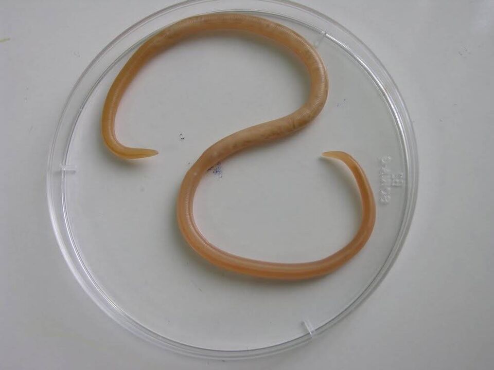 À quoi ressemblent les parasites chez les enfants
